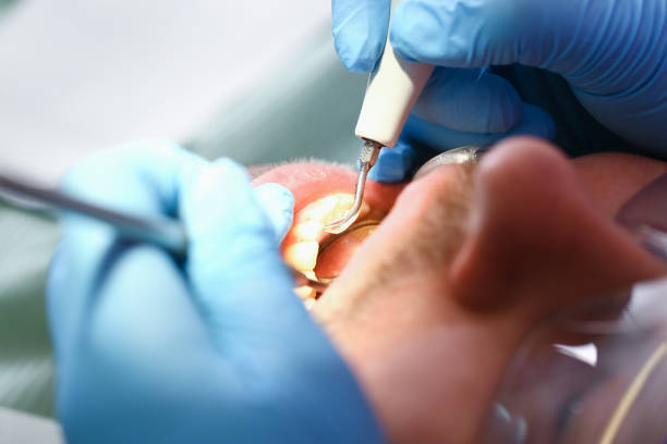 Best Broken Tooth Emergency  in Tool, TX